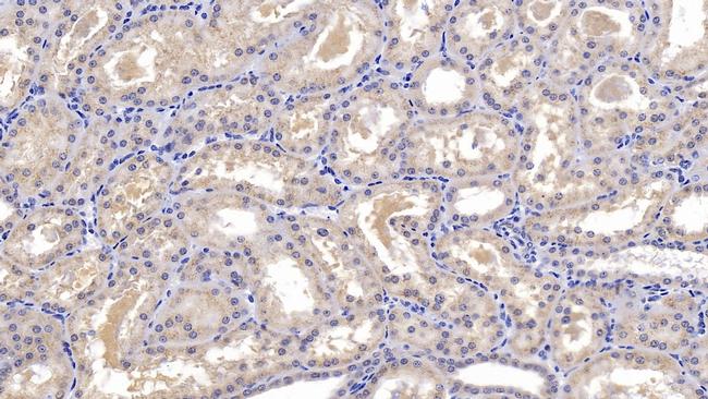 GC Antibody in Immunohistochemistry (Paraffin) (IHC (P))