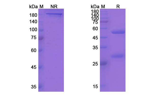 Yfc51.1Mab Humanized Antibody in SDS-PAGE (SDS-PAGE)