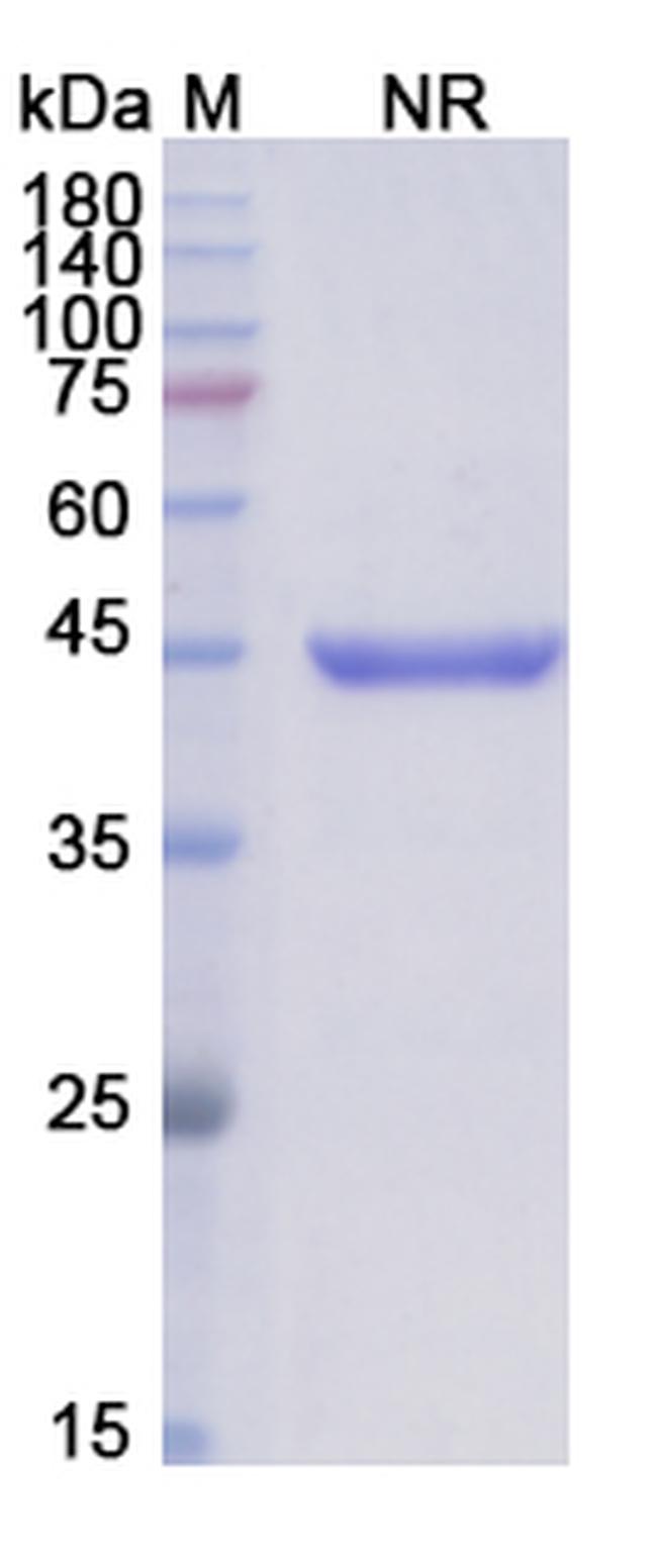 Abciximab Chimeric Antibody in SDS-PAGE (SDS-PAGE)