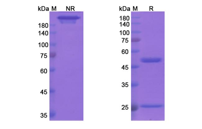 Bapineuzumab Humanized Antibody in SDS-PAGE (SDS-PAGE)