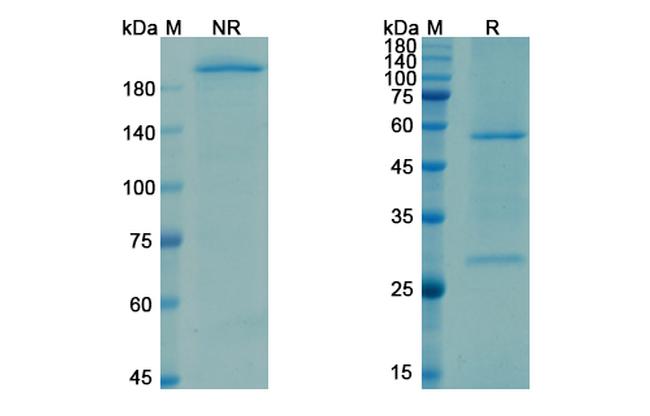 Opicinumab Antibody in SDS-PAGE (SDS-PAGE)