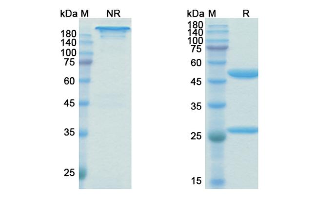 Birtamimab Chimeric Antibody in SDS-PAGE (SDS-PAGE)