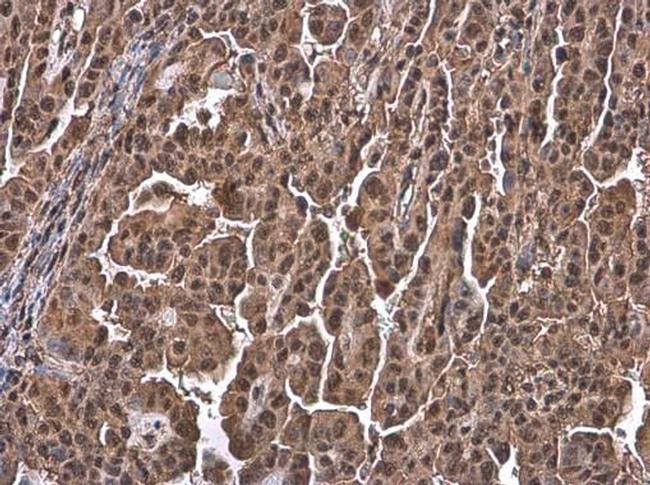 Ubiquitin Antibody in Immunohistochemistry (Paraffin) (IHC (P))