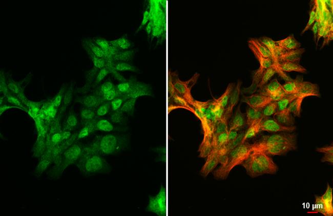 Androgen Receptor (ARv7 Splice Variant) Antibody in Immunocytochemistry (ICC/IF)