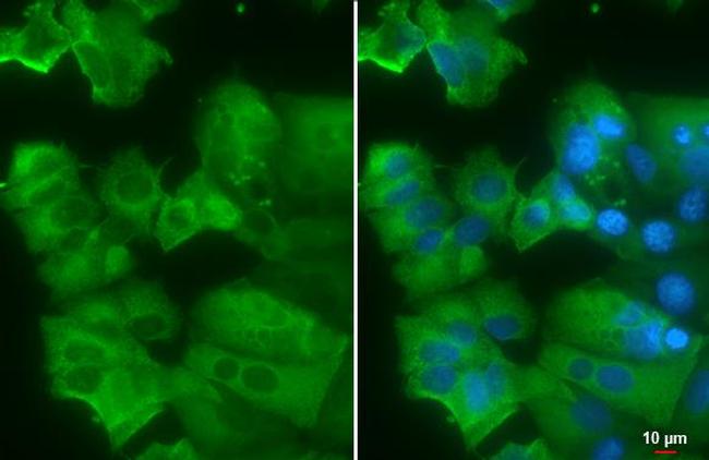 AGR2 Antibody in Immunocytochemistry (ICC/IF)