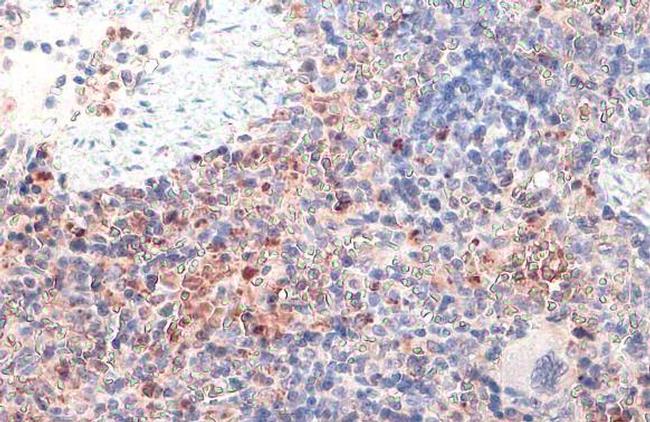 cIAP1 Antibody in Immunohistochemistry (Paraffin) (IHC (P))