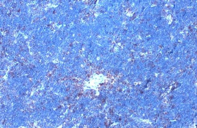 Phospho-GRK2 (Ser670) Antibody in Immunohistochemistry (Paraffin) (IHC (P))