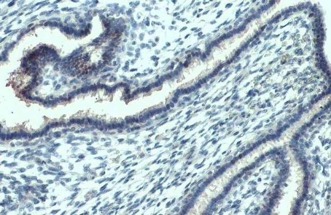 Phospho-JNK1 (Thr183, Tyr185) Antibody in Immunohistochemistry (Paraffin) (IHC (P))