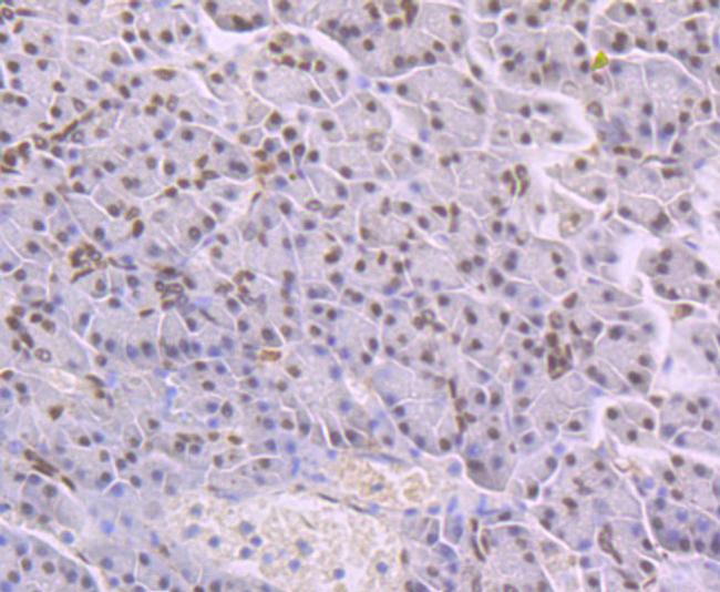 NFIB Antibody in Immunohistochemistry (Paraffin) (IHC (P))