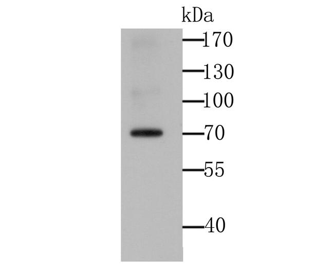 IGF2BP3 Antibody in Western Blot (WB)