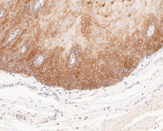 Cytokeratin 5/6 Antibody in Immunohistochemistry (Paraffin) (IHC (P))