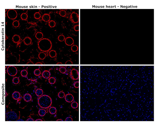 Cytokeratin 14 Antibody in Immunohistochemistry (Paraffin) (IHC (P))