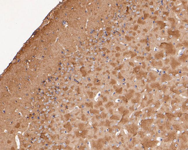 Dynamin 1 Antibody in Immunohistochemistry (Paraffin) (IHC (P))