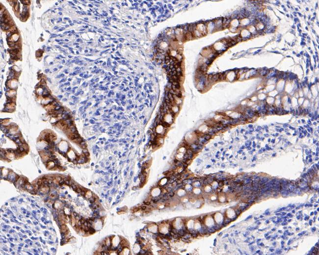 Cytokeratin 20 Antibody in Immunohistochemistry (Paraffin) (IHC (P))