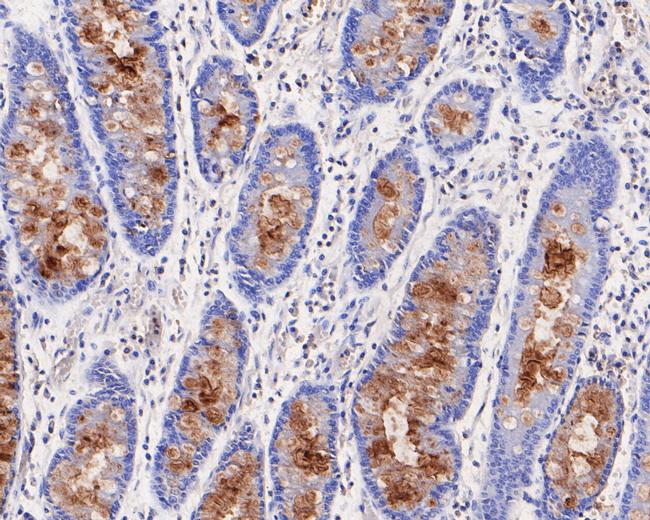 MUC5AC Antibody in Immunohistochemistry (Paraffin) (IHC (P))