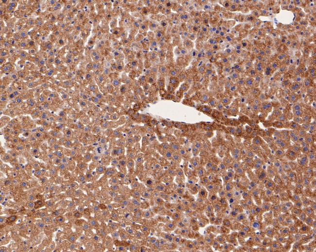 Glutamine Synthetase Antibody in Immunohistochemistry (Paraffin) (IHC (P))