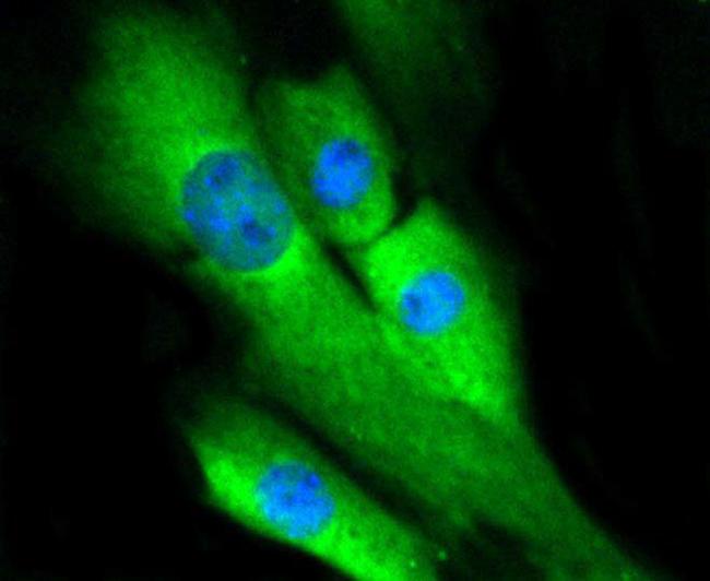 ERK1/ERK2 Antibody in Immunocytochemistry (ICC/IF)