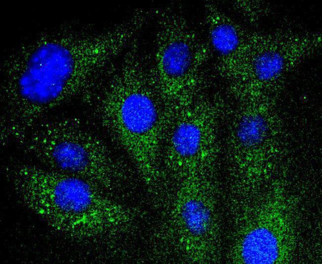 IkB alpha Antibody in Immunocytochemistry (ICC/IF)