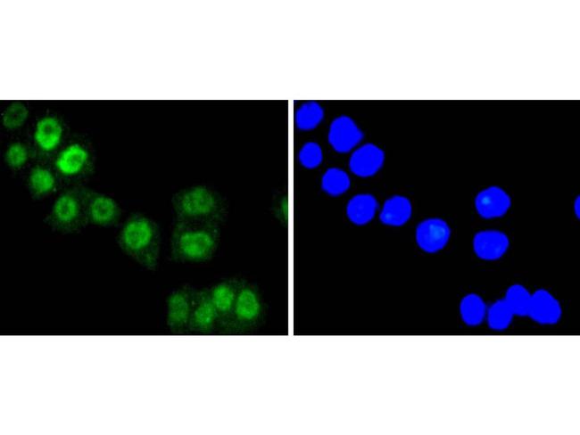 FOXO3A Antibody in Immunocytochemistry (ICC/IF)