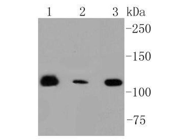 RNF20 Antibody in Western Blot (WB)