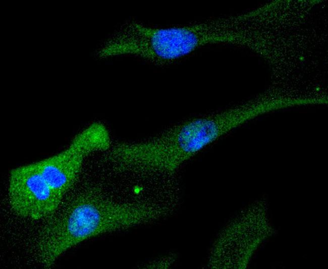 STAT6 Antibody in Immunocytochemistry (ICC/IF)