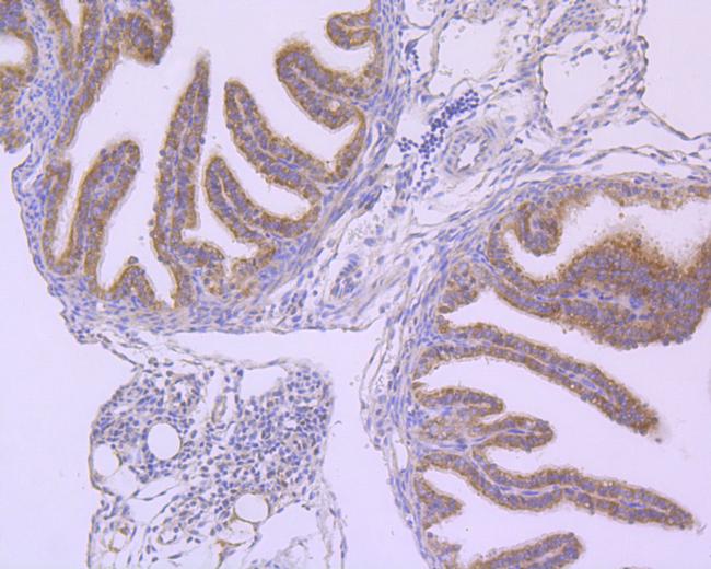 B-Raf Antibody in Immunohistochemistry (Paraffin) (IHC (P))