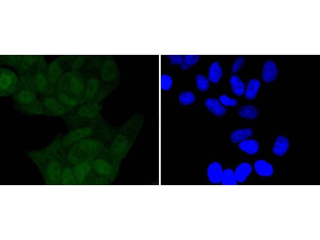 Phospho-IkB alpha (Ser32) Antibody in Immunocytochemistry (ICC/IF)