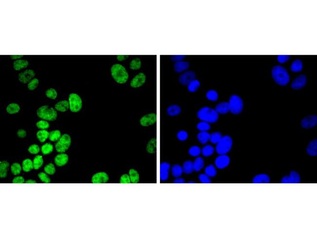 H2BK20ac Antibody in Immunocytochemistry (ICC/IF)