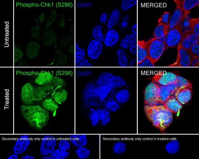 Phospho-Chk1 (Ser296) Antibody in Immunocytochemistry (ICC/IF)