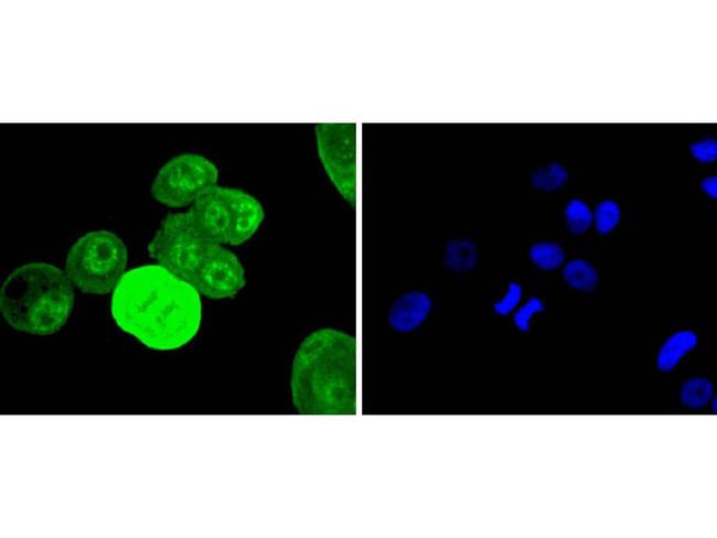 Phospho-EGFR (Tyr1068) Antibody in Immunocytochemistry (ICC/IF)