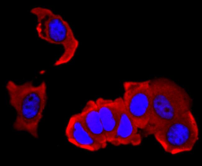 IL-4 Antibody in Immunocytochemistry (ICC/IF)