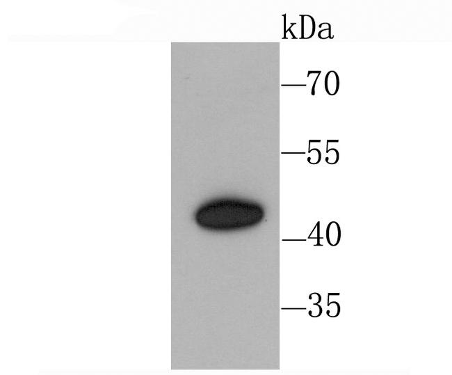 CXCR3 Antibody in Western Blot (WB)