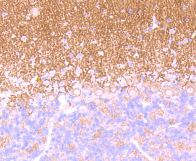 GABBR2 Antibody in Immunohistochemistry (Paraffin) (IHC (P))