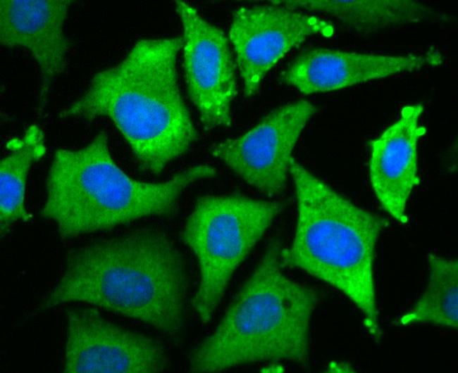 WNT2B Antibody in Immunocytochemistry (ICC/IF)