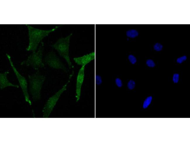 Phospho-CREB (Ser133) Antibody in Immunocytochemistry (ICC/IF)