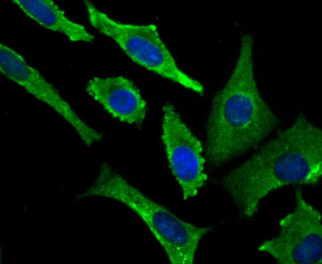 VAMP1 Antibody in Immunocytochemistry (ICC/IF)