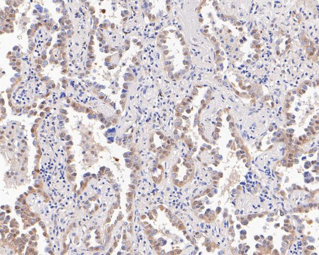 UBE4B Antibody in Immunohistochemistry (Paraffin) (IHC (P))