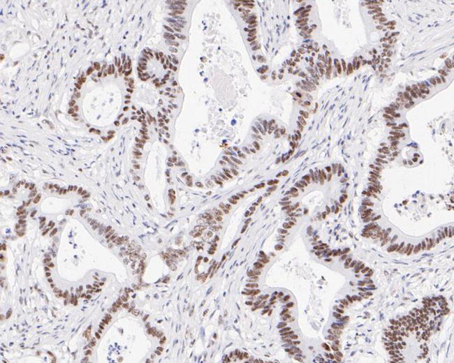 NAT10 Antibody in Immunohistochemistry (Paraffin) (IHC (P))