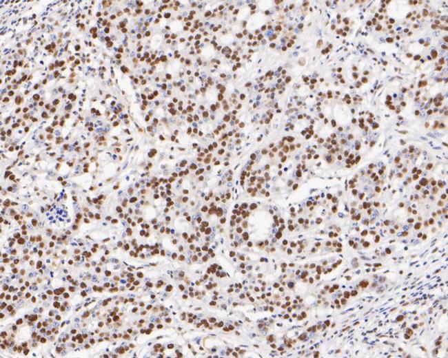 GATAD2A Antibody in Immunohistochemistry (Paraffin) (IHC (P))