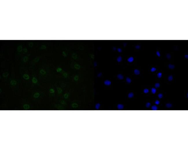 QKI Antibody in Immunocytochemistry (ICC/IF)