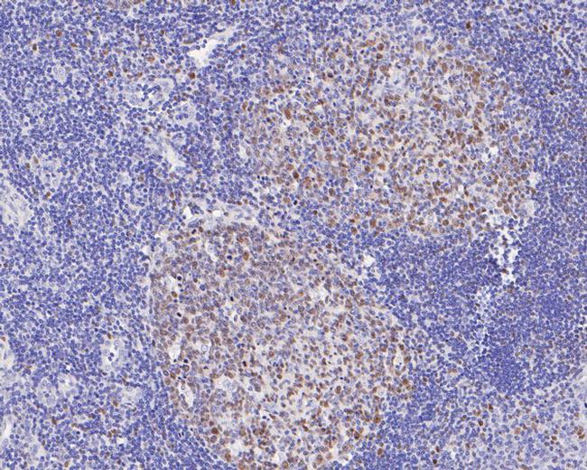 Oct-2 Antibody in Immunohistochemistry (Paraffin) (IHC (P))