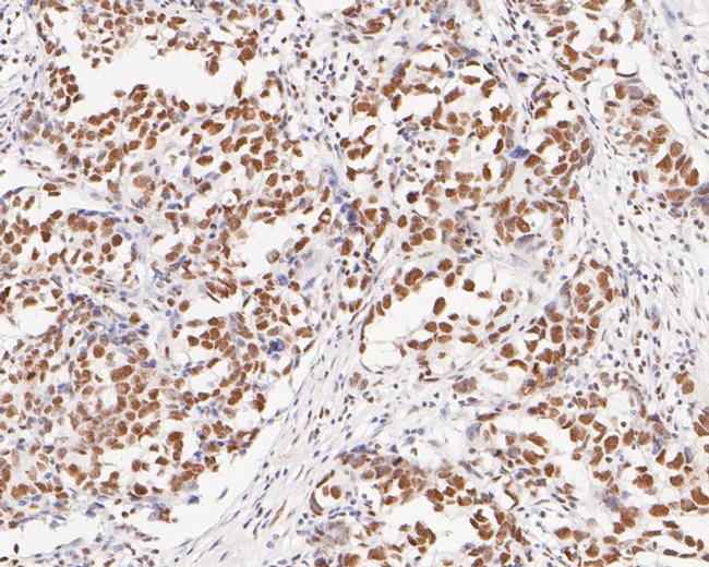 MBD2 Antibody in Immunohistochemistry (Paraffin) (IHC (P))