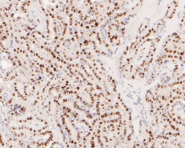 EGR1 Antibody in Immunohistochemistry (Paraffin) (IHC (P))