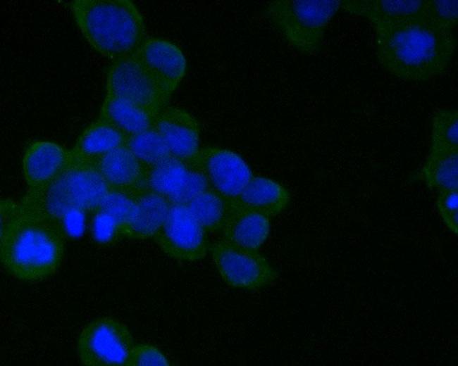 CD21 Antibody in Immunocytochemistry (ICC/IF)