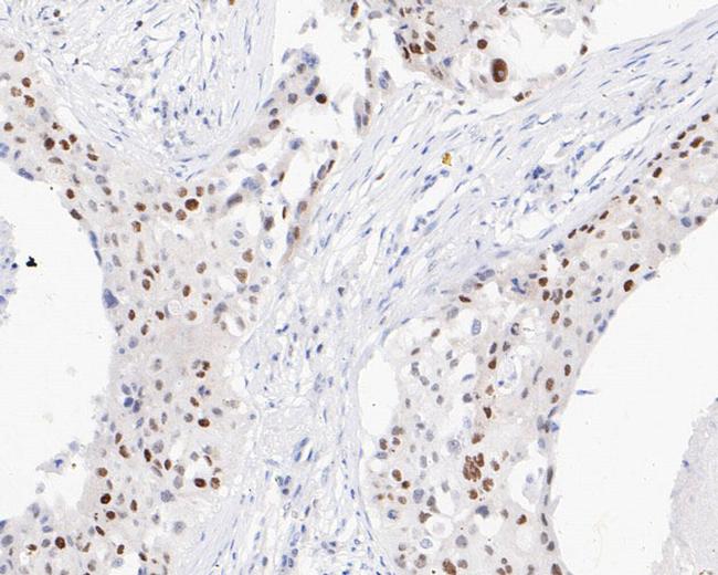 FEN1 Antibody in Immunohistochemistry (Paraffin) (IHC (P))