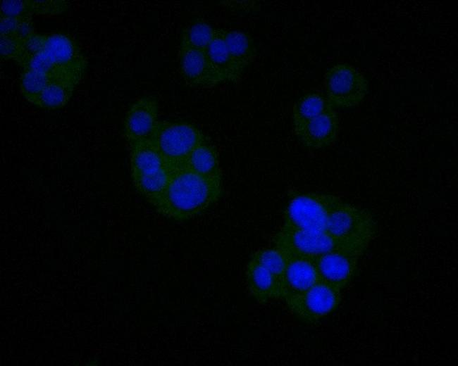 AGTR1 Antibody in Immunocytochemistry (ICC/IF)