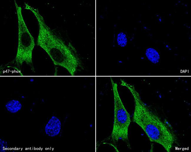 p47phox Antibody in Immunocytochemistry (ICC/IF)