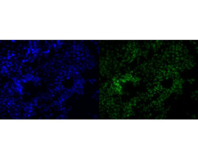 POLR2A Antibody in Immunocytochemistry (ICC/IF)