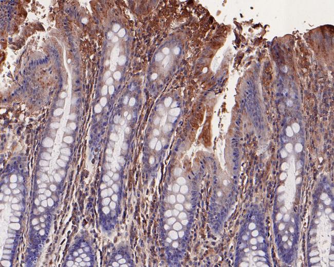 LRP6 Antibody in Immunohistochemistry (Paraffin) (IHC (P))