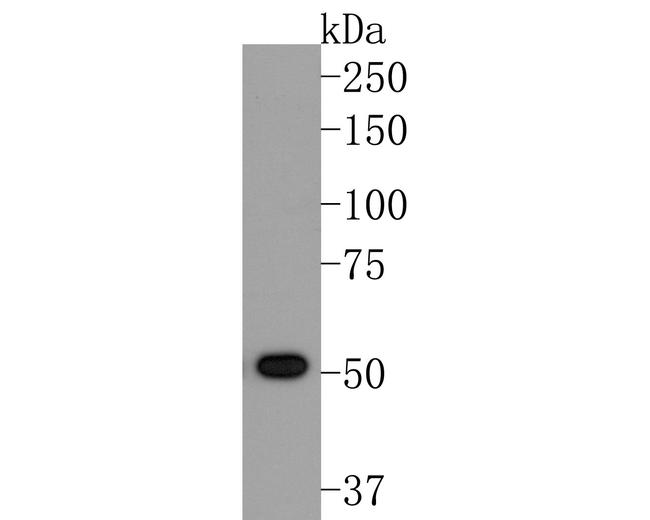 ACVR2B Antibody in Western Blot (WB)